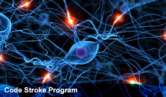 Code Stroke Program on an image of braincells