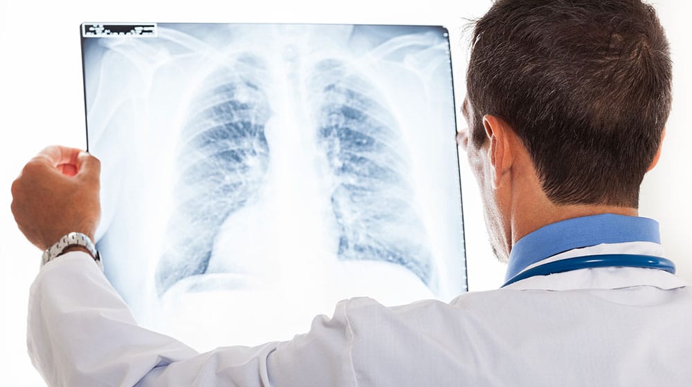 Doctor looking a chest xray