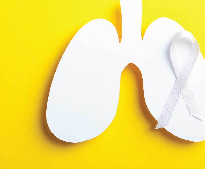 Lung Cancer Awareness Month: Tips for Navigating the Patient Journey