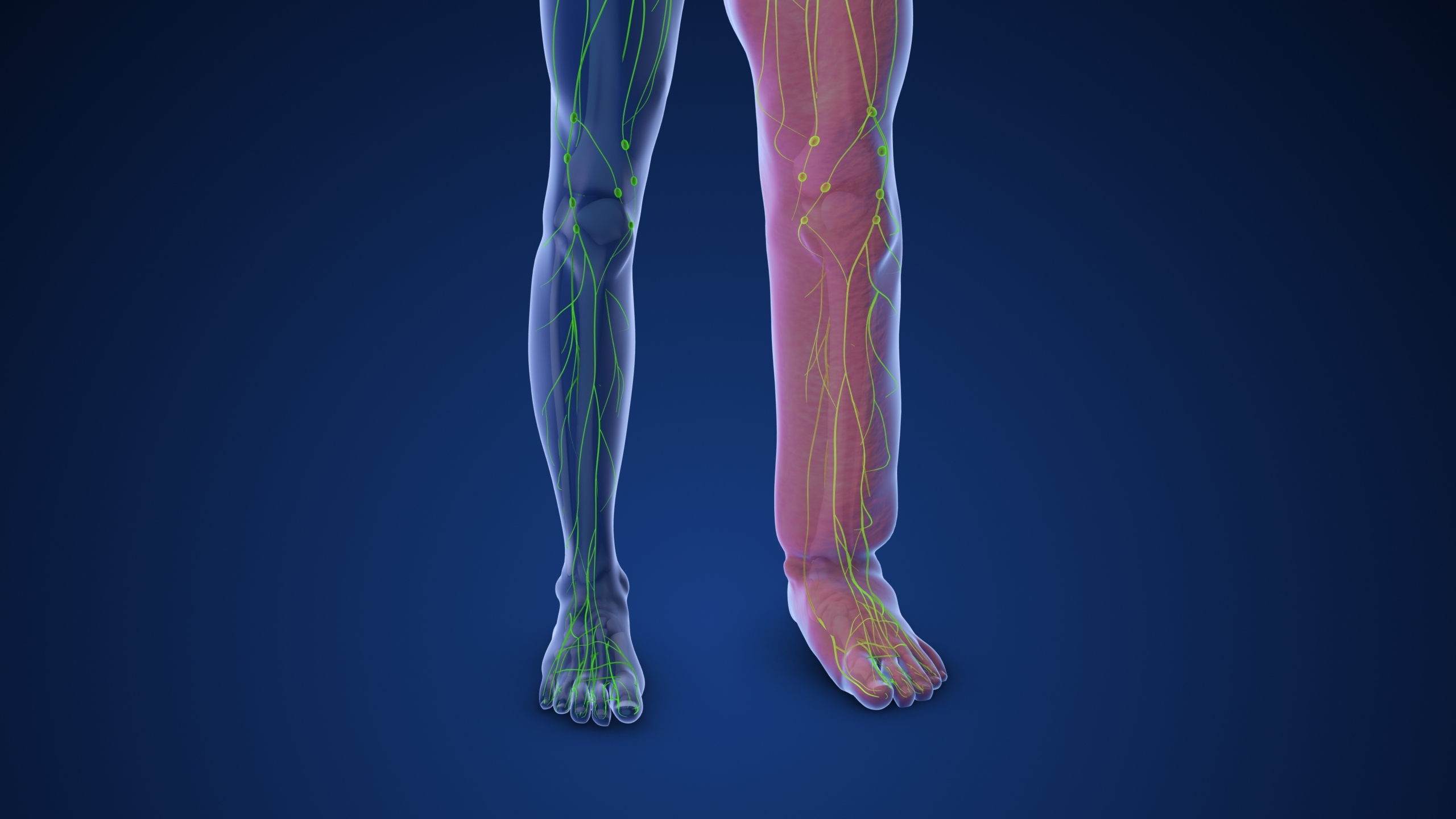 Lymphedema: What you need to know